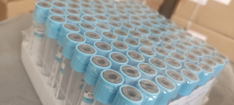 خرید لوله خونگیری وکیوم خلأ pt-ptt