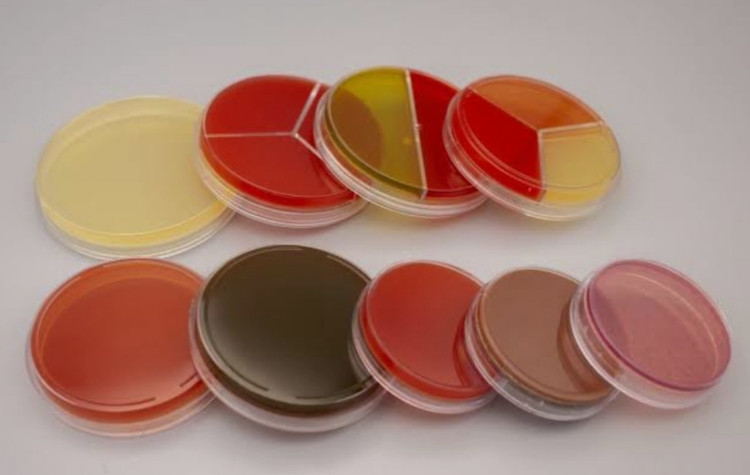 خرید محیط کشت آماده شکلات آگار پلیت ۸ سه خانه