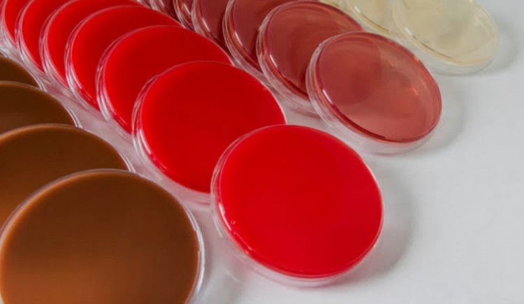 خرید محیط کشت آماده هکتون اینتریک ارزان