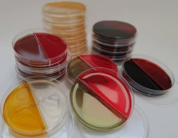 خرید محیط کشت آماده هکتون اینتریک پلیت ۶ پلیت ۸